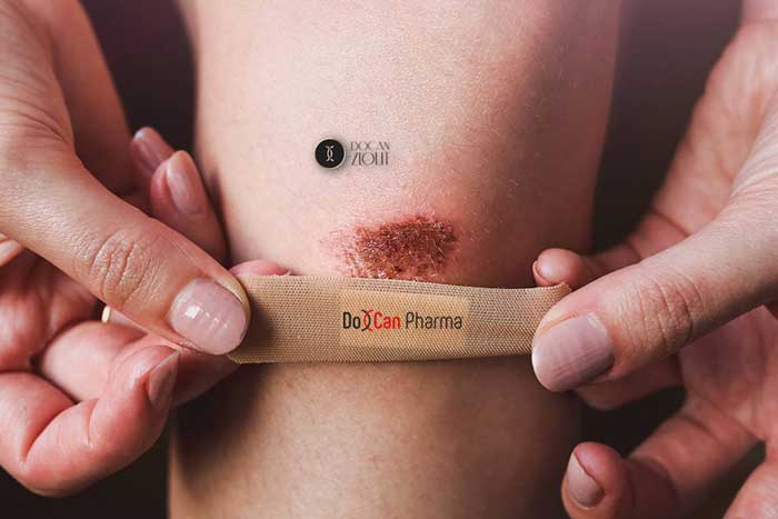 yara iyileşmesi ve Docan Zeolit; Aktif zeolitin yara iyileşmesindeki etkisi